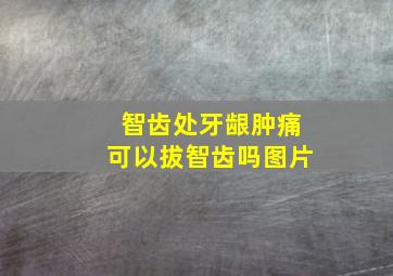 智齿处牙龈肿痛可以拔智齿吗图片