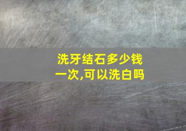 洗牙结石多少钱一次,可以洗白吗