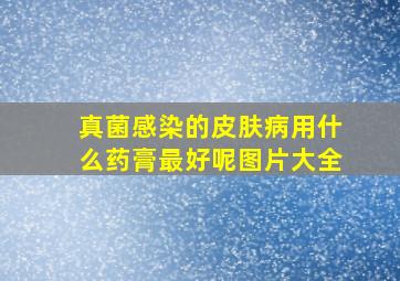 真菌感染的皮肤病用什么药膏最好呢图片大全