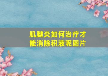 肌腱炎如何治疗才能消除积液呢图片