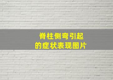 脊柱侧弯引起的症状表现图片