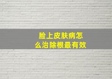 脸上皮肤病怎么治除根最有效