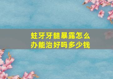 蛀牙牙髓暴露怎么办能治好吗多少钱